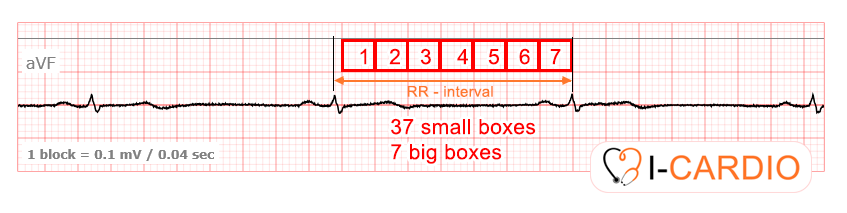 Determining Heart Rate (HR) ECG